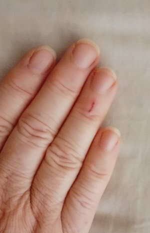 Not sure how I keep getting these small cuts