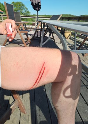So my friend biked down hill with a fire extinguisher, but almost got hit b...