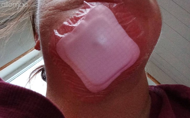 i didnt wanna post gross or scary, im home and doing my own dressings, so l...